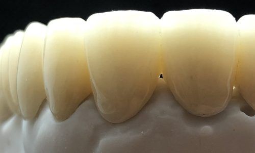 laboratorio protesis dental majadahonda ferulas aparatos dentales feliciano perez
