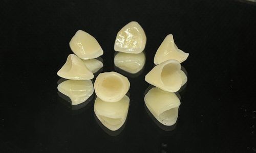 laboratorio protesis dental majadahonda ferulas aparatos dentales feliciano perez